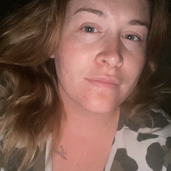 Acne system! - Picture 4 of 4